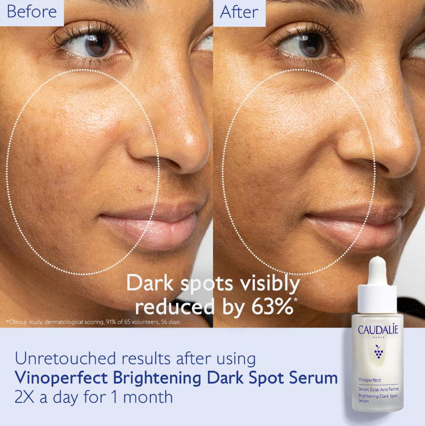 Caudalie Vinoperfect Brightening Routine for Dark Spots and Uneven Skin Tone *Pre Orden* - Beautyland by Rocio 