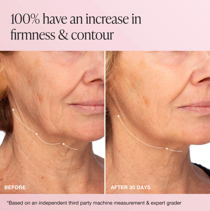 Innbeauty Project  Extreme Cream Anti-Aging, Firming, & Lifting Refillable Moisturizer *Pre Orden*