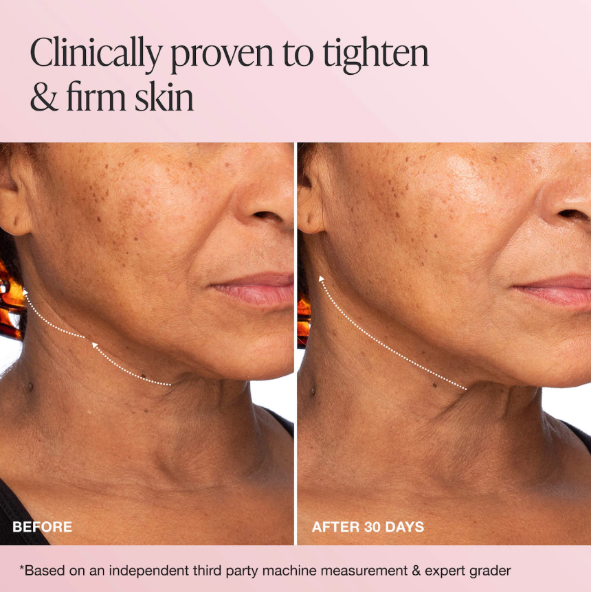Innbeauty Project  Extreme Cream Anti-Aging, Firming, & Lifting Refillable Moisturizer *Pre Orden*