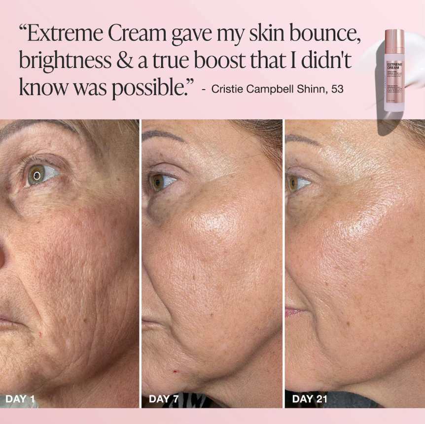 Innbeauty Project  Extreme Cream Anti-Aging, Firming, & Lifting Refillable Moisturizer *Pre Orden*