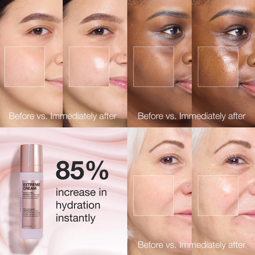 Innbeauty Project  Extreme Cream Anti-Aging, Firming, & Lifting Refillable Moisturizer *Pre Orden*