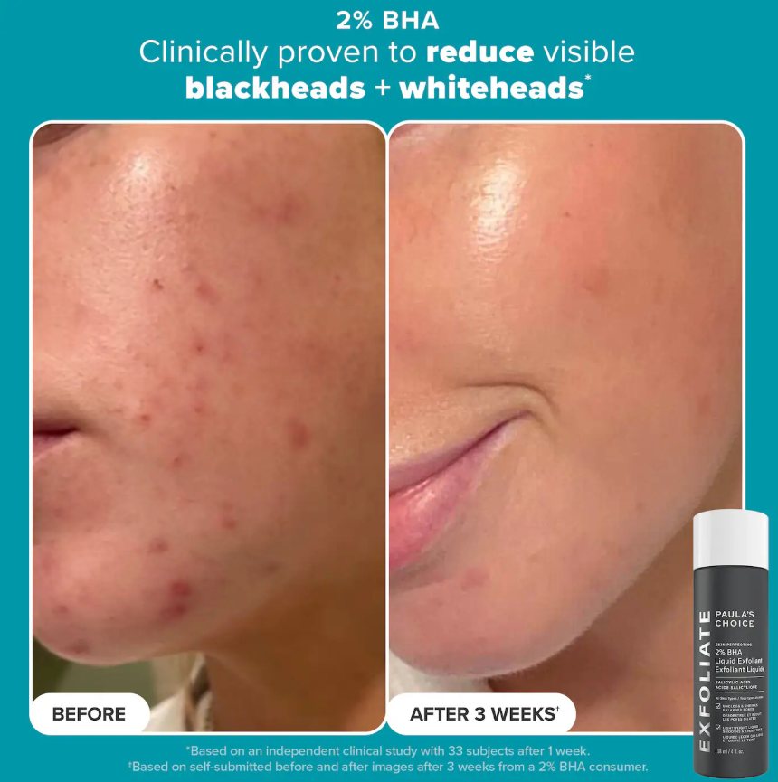Paula's Choice Smooth & Glow Gift Set for clearer, brighter skin *Pre Orden*