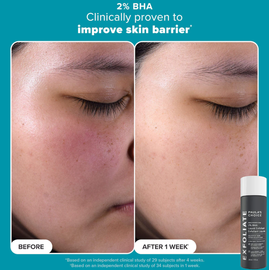 Paula's Choice Smooth & Glow Gift Set for clearer, brighter skin *Pre Orden*
